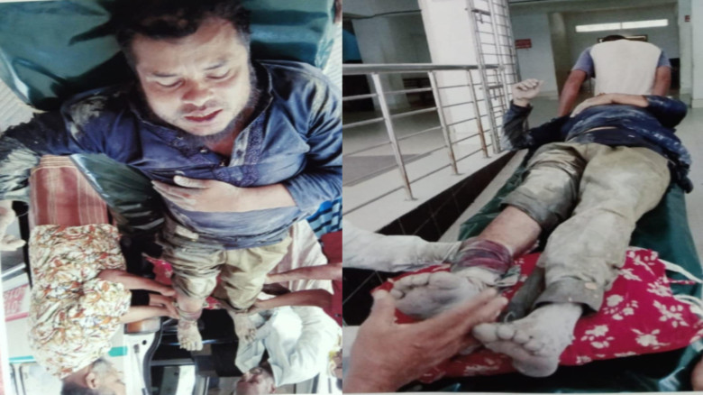 রামপালে সন্ত্রাসীদের হামলায় আহত ১, থানায় মামলা