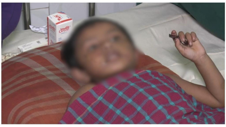 দৌলতখানে খুন্তি পুড়িয়ে চার বছরের শিশুর শরীরে ছ্যাঁকা দিলো 