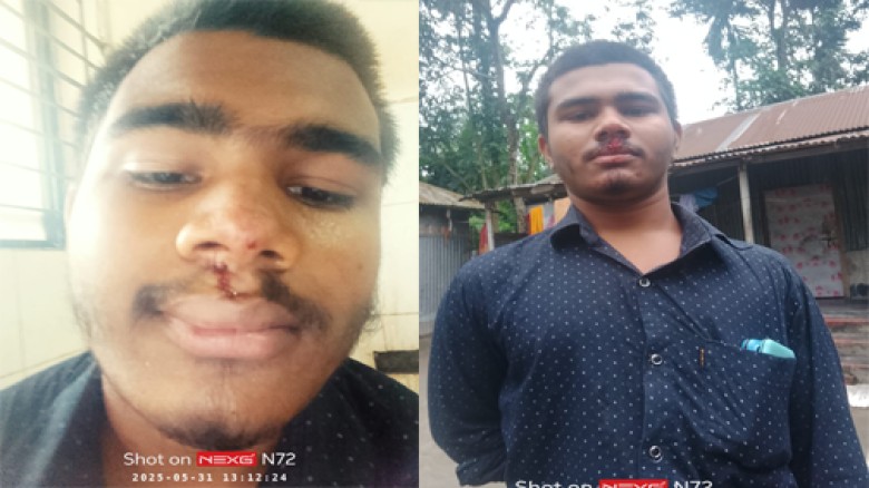 লালমনিরহাটে যুবককে কুপিয়ে হত্যাচেষ্টা, হামলার সময় গৃহবধূকে