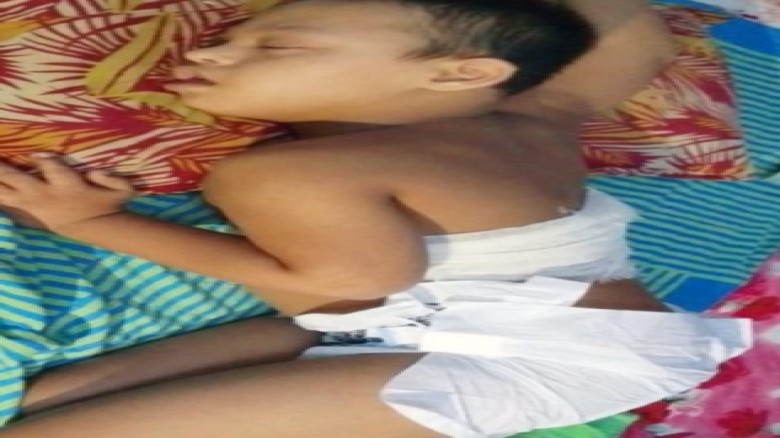 হবিগঞ্জ আধুনিক সদর হাসপাতালে আহত প্রতিবন্ধী শিশুর চিকিৎসায় অ
