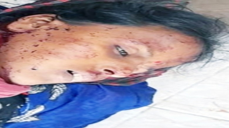 হবিগঞ্জ জেলার নবীগঞ্জে বাবার দায়ের কোপে মেয়ের মৃত্যু ॥ পিতা 